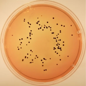 Dezoxicolat Agar