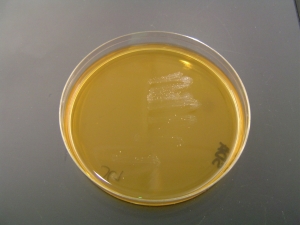 Sabouraud Dextroza Agar